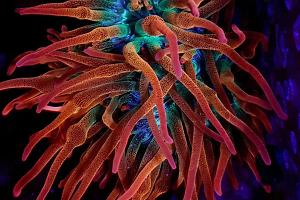 Forest Fire Bubble Tip Anemone Thumbnail